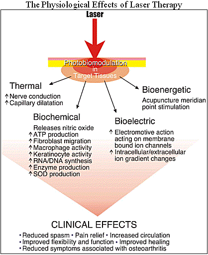 Effects of class 4 laser therapy