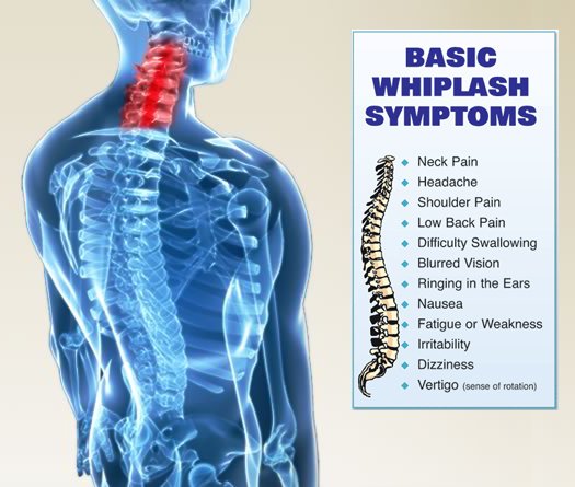 whiplash symptoms